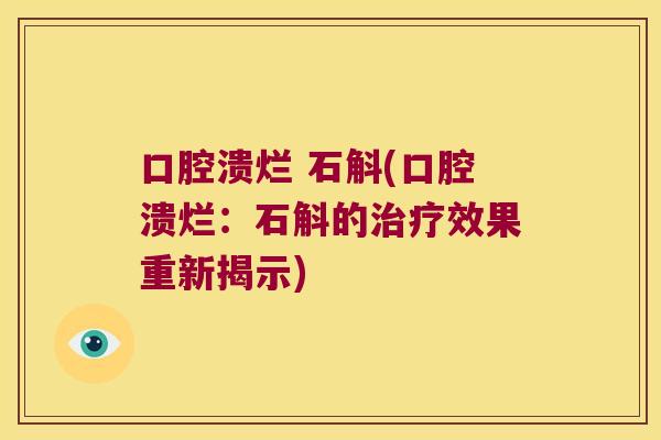 口腔溃烂 石斛(口腔溃烂：石斛的治疗效果重新揭示)