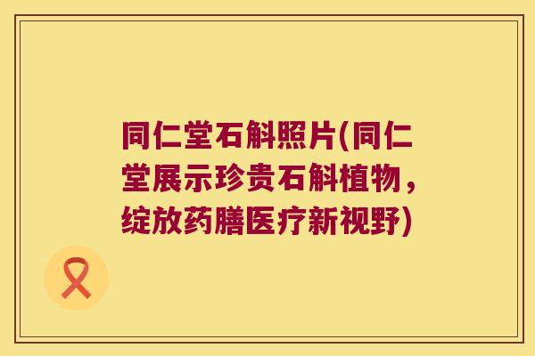 同仁堂石斛照片(同仁堂展示珍贵石斛植物，绽放药膳医疗新视野)