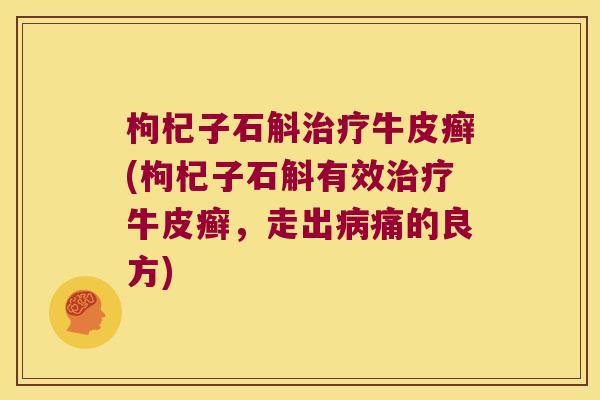 枸杞子石斛治疗牛皮癣(枸杞子石斛有效治疗牛皮癣，走出病痛的良方)