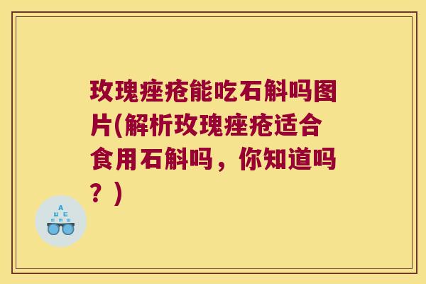 玫瑰痤疮能吃石斛吗图片(解析玫瑰痤疮适合食用石斛吗，你知道吗？)