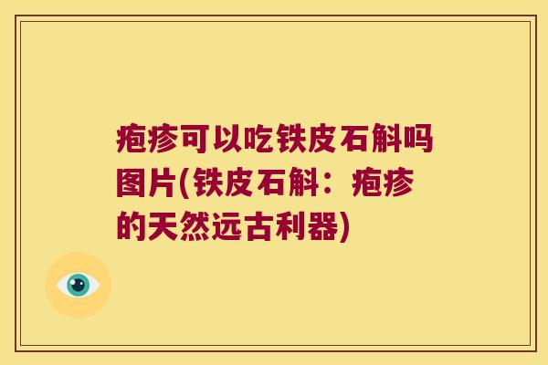 疱疹可以吃铁皮石斛吗图片(铁皮石斛：疱疹的天然远古利器)