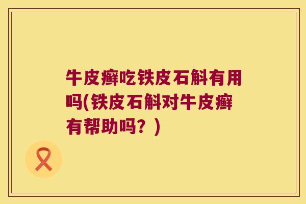 牛皮癣吃铁皮石斛有用吗(铁皮石斛对牛皮癣有帮助吗？)